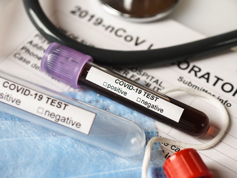 Coronavirus Update: 83 Cases Confirmed in Fresno County