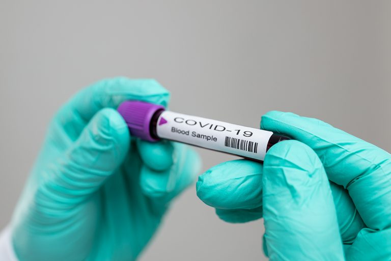 Coronavirus Update: 93 Cases Confirmed in Fresno County